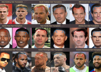 Does John Cena Have Baldness? Find Out About His Hairline